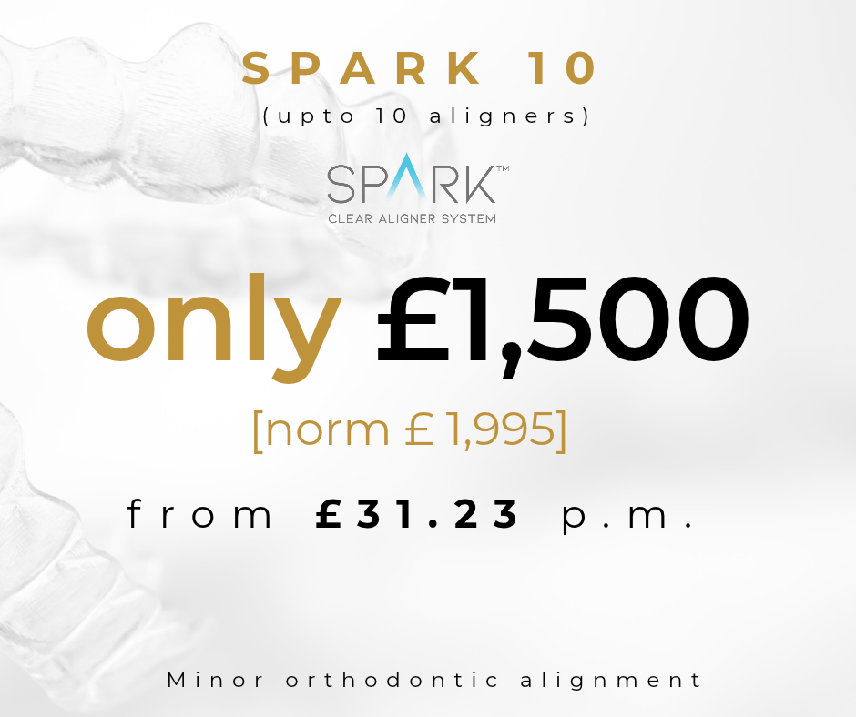 Spark 10 aligner price £1500