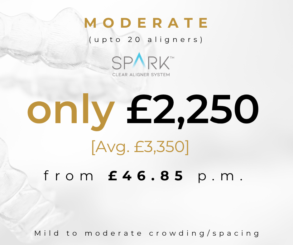 Spark Moderate aligner price £2250